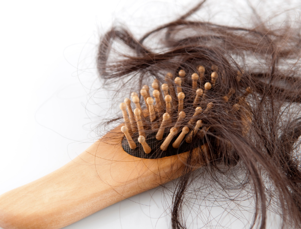 which vitamin deficiency causes hair loss